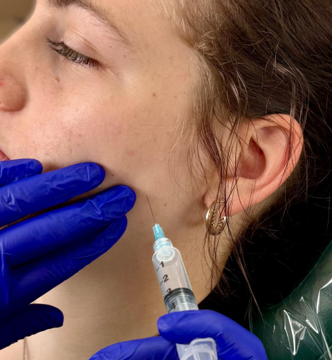 Trigger Point Injection – 3 Trigger Point Injection - 3